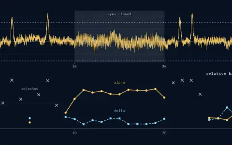 Two stacked panels over 0 to 30 s. EEG panel: the synthetic record in µV, from −46.3 to 111.5, against dotted reject levels at plus and minus 75 µV; four blinks rise above the upper one; the eyes-closed span, 10 to 20 s, is shaded. Relative band power panel: 29 windows of 29 drawn, centred at 1 to 29 s; alpha's share as dots on a solid line, delta's as squares on a dashed line; 10 rejected windows (centred at 2, 3, 4, 6, 7, 8, 21, 22, 23 and 24 s) shown as open crosses at their delta share. Span 20 to 30 s: alpha 22 %, delta 28 %, mean over the kept windows.